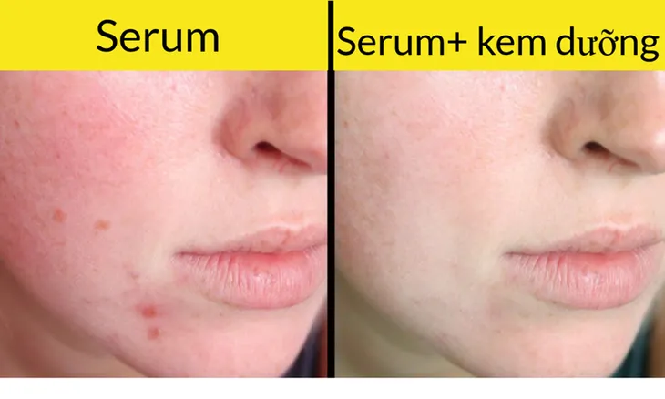 8 sai lầm khiến sản phẩm làm đẹp phản tác dụng - Ảnh 2. 8 sai lầm khiến sản phẩm làm đẹp phản tác dụng - Ảnh 2.