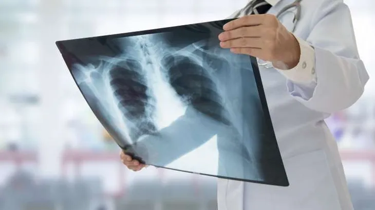 Những tác hại khi ngồi quá lâu khiến dân văn phòng không thể phớt lờ - Ảnh 6. Những tác hại khi ngồi quá lâu khiến dân văn phòng không thể phớt lờ - Ảnh 6.