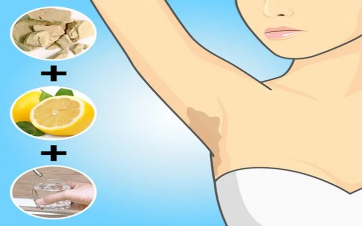 8 cách trị thâm nách hiệu quả bằng nguyên liệu tự nhiên - Ảnh 6.
