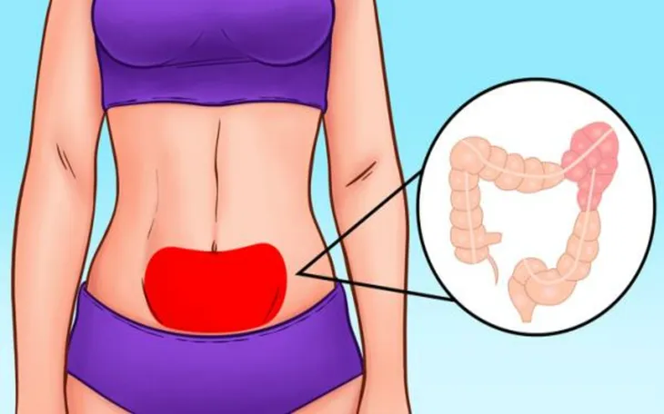 Vị trí đau bụng tiết lộ gì về sức khỏe của bạn? - Ảnh 4. Vị trí đau bụng tiết lộ gì về sức khỏe của bạn? - Ảnh 4.