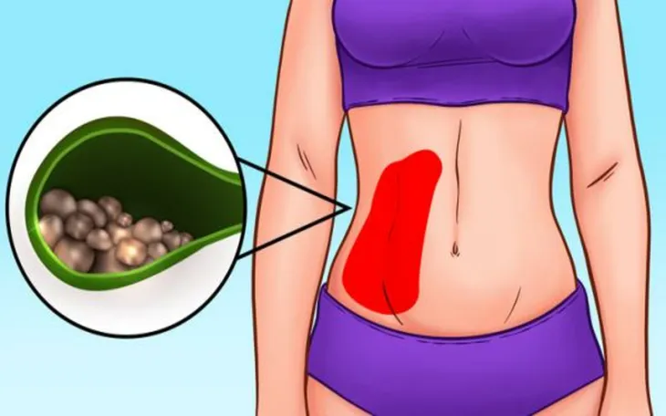 Vị trí đau bụng tiết lộ gì về sức khỏe của bạn? - Ảnh 6. Vị trí đau bụng tiết lộ gì về sức khỏe của bạn? - Ảnh 6.
