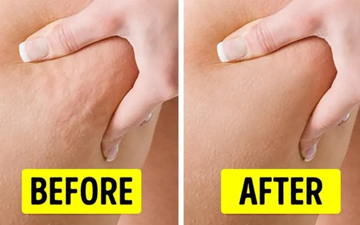 Tác dụng làm đẹp của cà phê - Ảnh 4.
