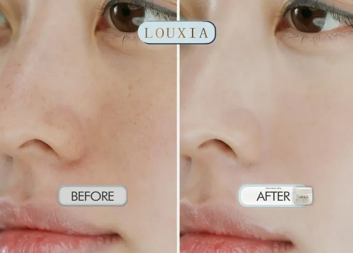 Louxia - siêu phẩm chăm sóc da thách thức thời gian - Ảnh 2. Louxia - siêu phẩm chăm sóc da thách thức thời gian - Ảnh 2.