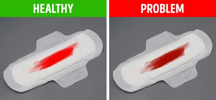 8 dấu hiệu sức khỏe xuống cấp mà phụ nữ hay bỏ qua - Ảnh 5.