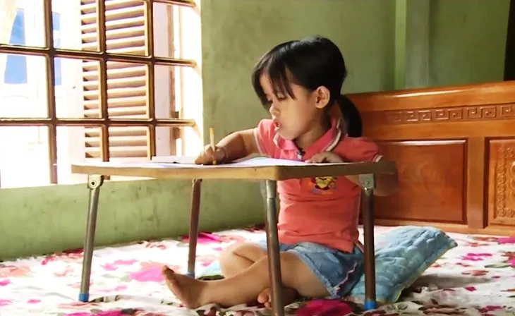 Cô bé xương thủy tinh, nghị lực kim cương - Ảnh 2.