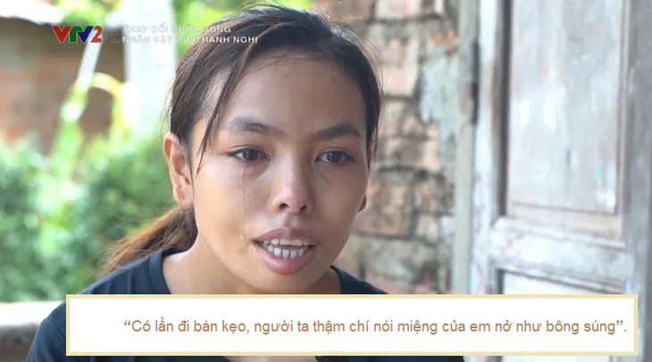 Change Life: Cô gái miệng như bông súng khiến chồng bất ngờ sau phẫu thuật thẩm mỹ - Ảnh 1. Change Life: Cô gái miệng như bông súng khiến chồng bất ngờ sau phẫu thuật thẩm mỹ - Ảnh 1.