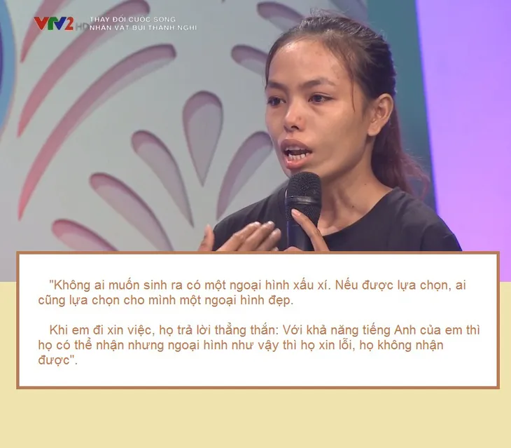 Change Life: Cô gái miệng như bông súng khiến chồng bất ngờ sau phẫu thuật thẩm mỹ - Ảnh 2. Change Life: Cô gái miệng như bông súng khiến chồng bất ngờ sau phẫu thuật thẩm mỹ - Ảnh 2.