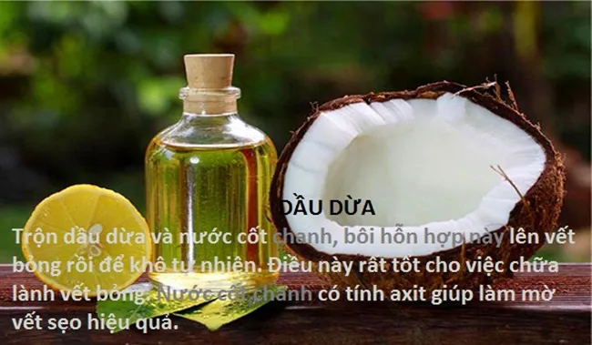 10 mẹo chữa bỏng tại nhà hiệu quả - Ảnh 4. 10 mẹo chữa bỏng tại nhà hiệu quả - Ảnh 4.