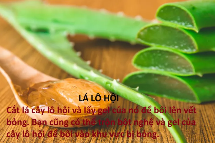 10 mẹo chữa bỏng tại nhà hiệu quả - Ảnh 2. 10 mẹo chữa bỏng tại nhà hiệu quả - Ảnh 2.