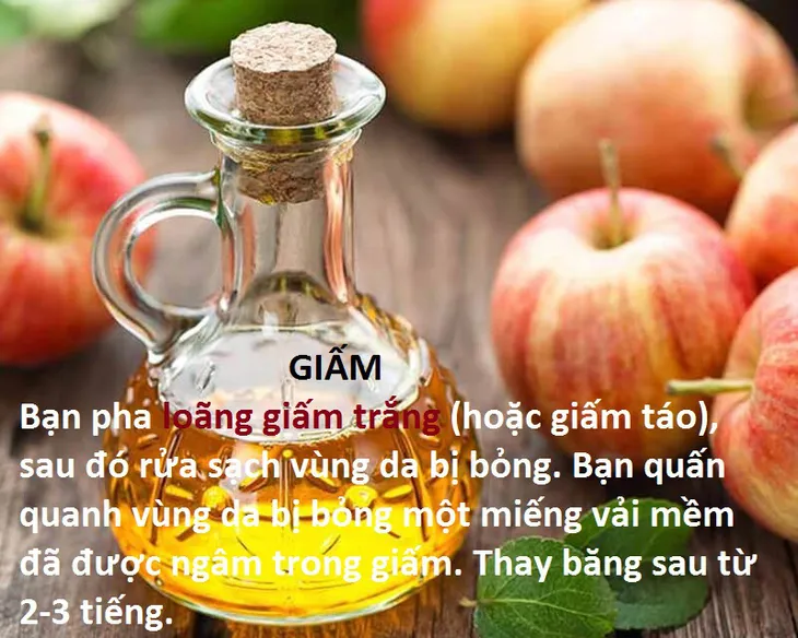 10 mẹo chữa bỏng tại nhà hiệu quả - Ảnh 6. 10 mẹo chữa bỏng tại nhà hiệu quả - Ảnh 6.