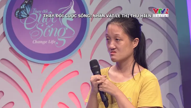 Change Life: Cô gái Huế hở hàm ếch thay đổi ra sao sau phẫu thuật thẩm mỹ? - Ảnh 4. Change Life: Cô gái Huế hở hàm ếch thay đổi ra sao sau phẫu thuật thẩm mỹ? - Ảnh 4.