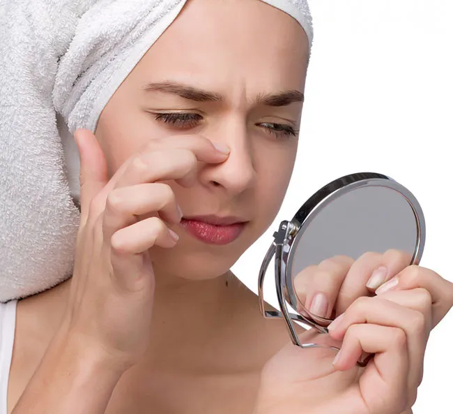 6 sai lầm thường gặp khi nặn mụn đầu đen - Ảnh 1. 6 sai lầm thường gặp khi nặn mụn đầu đen - Ảnh 1.