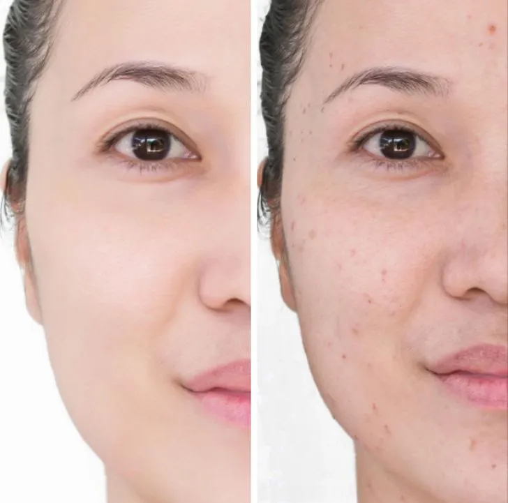 6 tác hại khó lường từ khăn ướt tẩy trang - Ảnh 2. 6 tác hại khó lường từ khăn ướt tẩy trang - Ảnh 2.