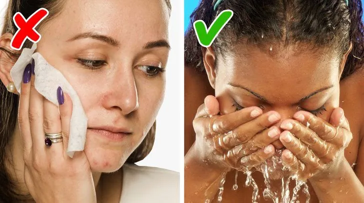 6 tác hại khó lường từ khăn ướt tẩy trang - Ảnh 6. 6 tác hại khó lường từ khăn ướt tẩy trang - Ảnh 6.