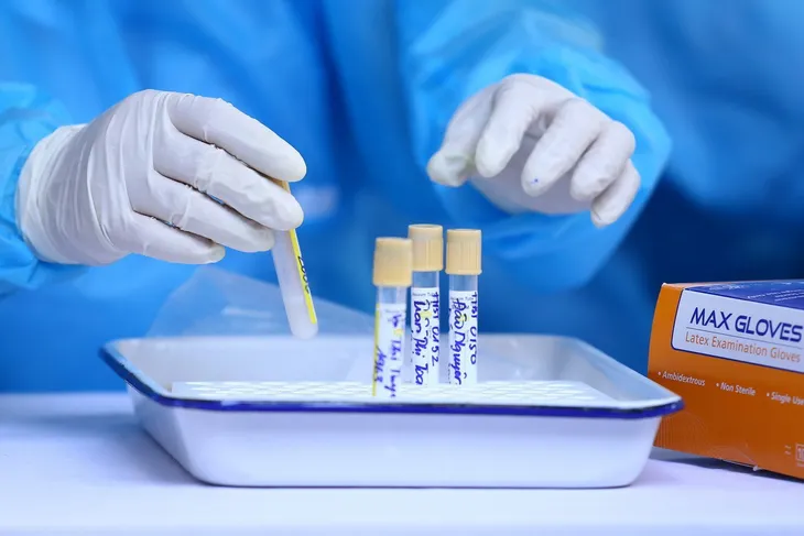 Dừng test nhanh, tối ưu hóa xét nghiệm PCR - chiến lược giúp kiểm soát COVID-19 - Ảnh 4. Dừng test nhanh, tối ưu hóa xét nghiệm PCR - chiến lược giúp kiểm soát COVID-19 - Ảnh 4.