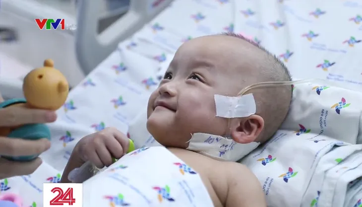 1 tháng sau phẫu thuật tách dính, Song Nhi ngồi dậy nô đùa cùng y bác sĩ - Ảnh 3. 1 tháng sau phẫu thuật tách dính, Song Nhi ngồi dậy nô đùa cùng y bác sĩ - Ảnh 3.
