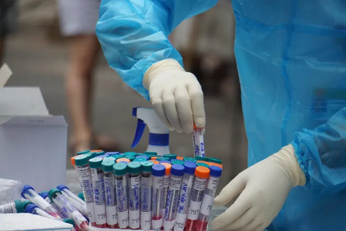 Kết quả test nhanh âm tính vẫn nên cách ly đủ 14 ngày - Ảnh 1. Kết quả test nhanh âm tính vẫn nên cách ly đủ 14 ngày - Ảnh 1.