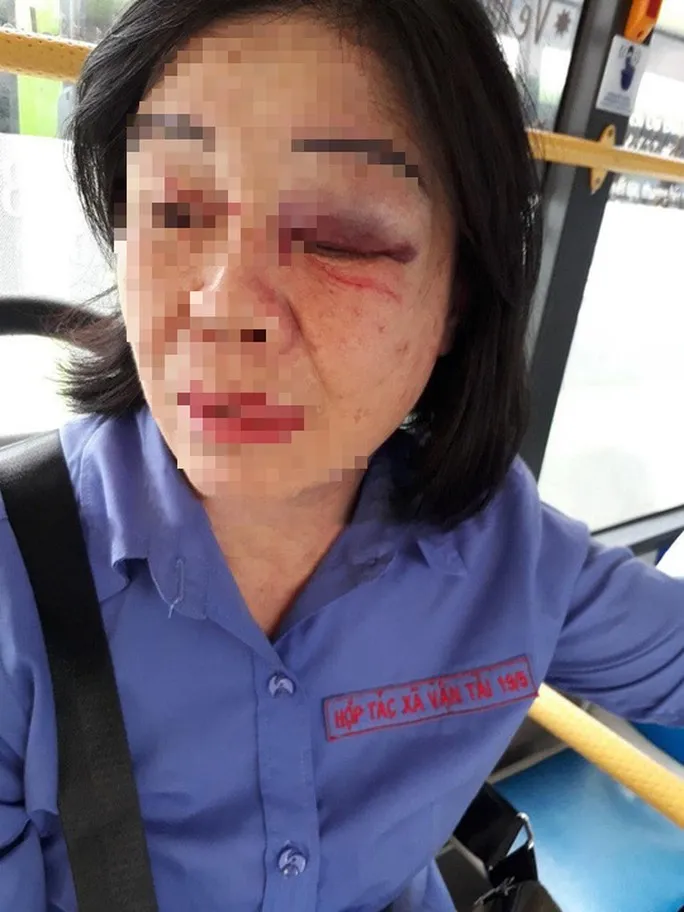 Hàng loạt vụ người nhắc nhở, góp ý bị ăn chửi, thậm chí... ăn đòn - Ảnh 1. Hàng loạt vụ người nhắc nhở, góp ý bị ăn chửi, thậm chí... ăn đòn - Ảnh 1.