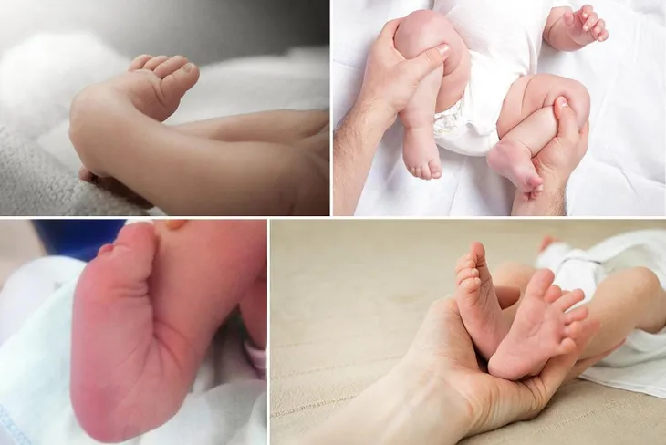 Tư vấn trực tuyến: Phát hiện sớm dị tật, bất thường cơ xương khớp ở trẻ để điều trị hiệu quả - Ảnh 1. Tư vấn trực tuyến: Phát hiện sớm dị tật, bất thường cơ xương khớp ở trẻ để điều trị hiệu quả - Ảnh 1.