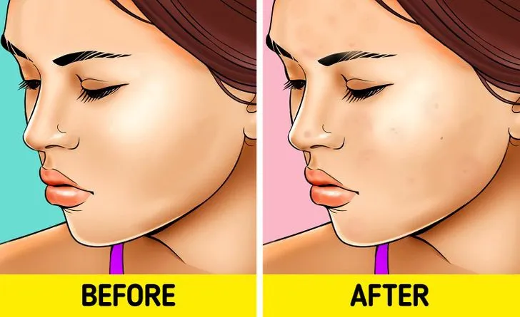 7 điều sẽ khiến bạn hối hận nếu không tẩy trang trước khi ngủ - Ảnh 2. 7 điều sẽ khiến bạn hối hận nếu không tẩy trang trước khi ngủ - Ảnh 2.