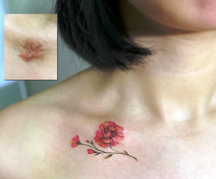 Cô gái hô biến những vết sẹo bằng hình xăm - Ảnh 2. Cô gái hô biến những vết sẹo bằng hình xăm - Ảnh 2.