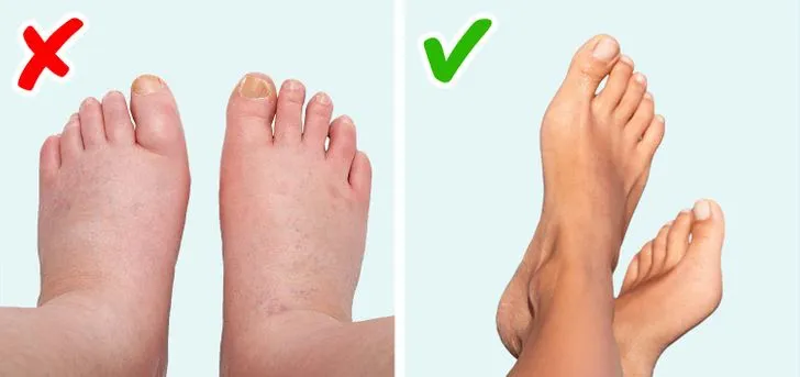 10 dấu hiệu cảnh báo bạn đang có vấn đề về sức khỏe - Ảnh 4. 10 dấu hiệu cảnh báo bạn đang có vấn đề về sức khỏe - Ảnh 4.
