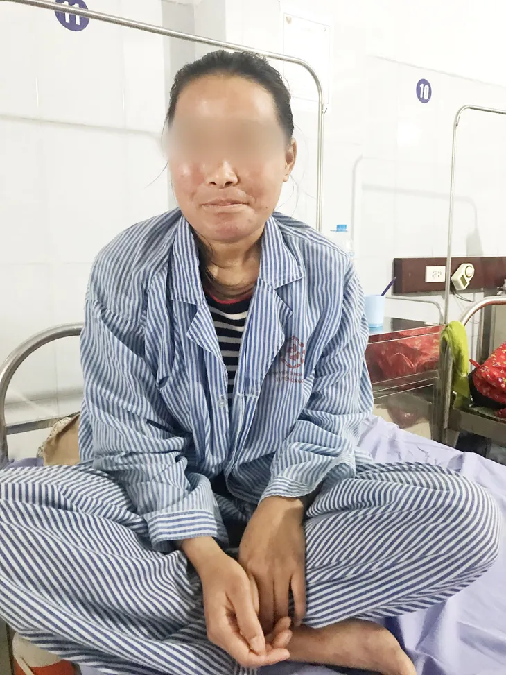 Phù mặt lở loét do dị ứng... kem trộn - Ảnh 1. Phù mặt lở loét do dị ứng... kem trộn - Ảnh 1.