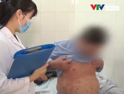Cẩn trọng với bệnh về da mùa lạnh - Ảnh 2. Cẩn trọng với bệnh về da mùa lạnh - Ảnh 2.