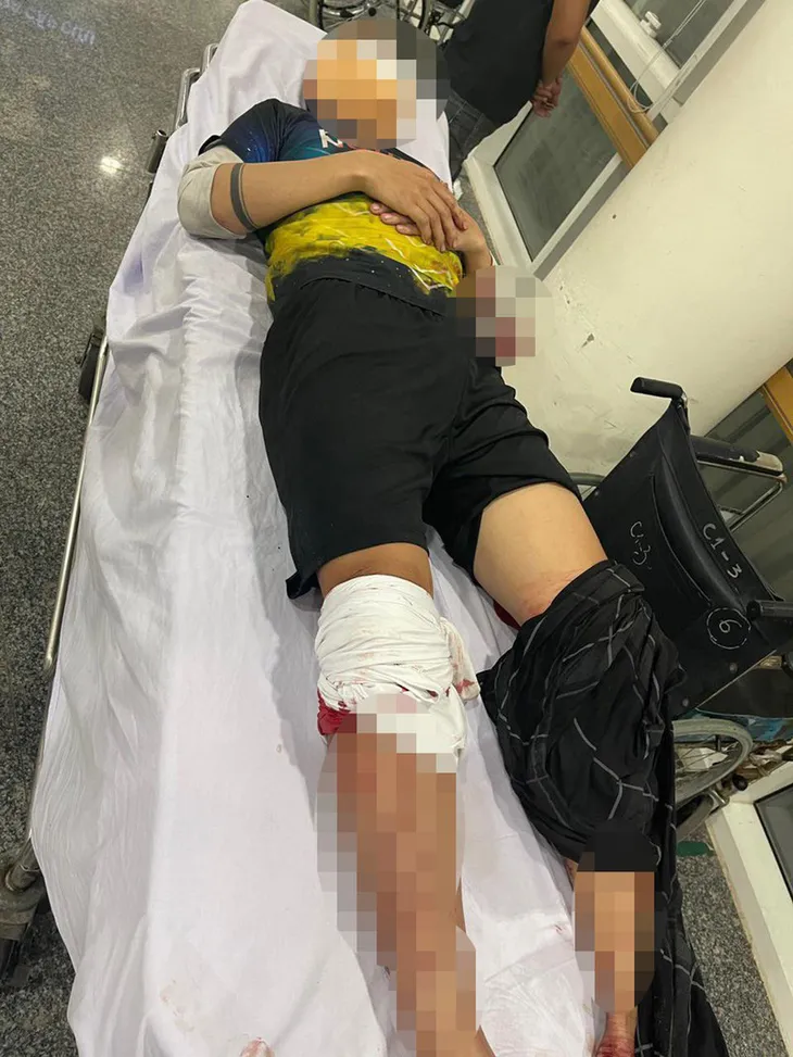 Mâu thuẫn trên sân bóng, nam thanh niên bị chém trọng thương - Ảnh 2. Mâu thuẫn trên sân bóng, nam thanh niên bị chém trọng thương - Ảnh 2.