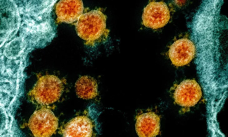 Phát hiện bệnh nhân nhiễm đến 2 biến thể virus corona - Ảnh 2. Phát hiện bệnh nhân nhiễm đến 2 biến thể virus corona - Ảnh 2.