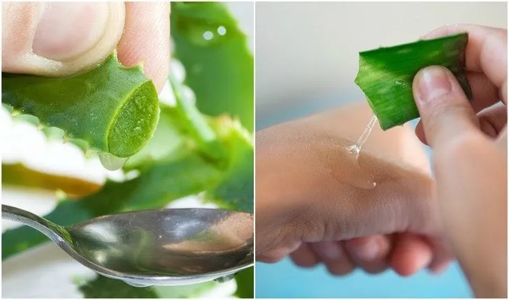 10 mẹo giảm thâm nám da tự nhiên mà hiệu quả - Ảnh 4. 10 mẹo giảm thâm nám da tự nhiên mà hiệu quả - Ảnh 4.