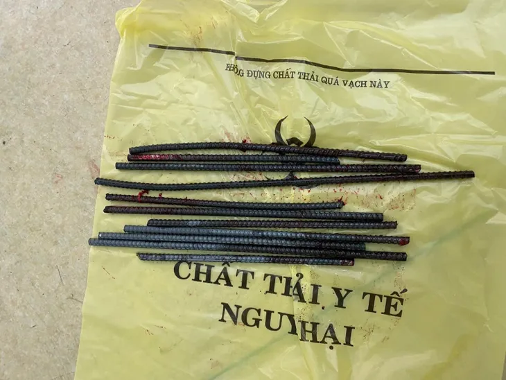 Va chạm với xe ba gác chở sắt, nam thanh niên bị 11 thanh sắt đâm xuyên chân - Ảnh 1.