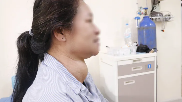 Nữ bệnh nhân được giải thoát khỏi khối u tuyến giáp khổng lồ suốt 16 năm - Ảnh 1. Nữ bệnh nhân được giải thoát khỏi khối u tuyến giáp khổng lồ suốt 16 năm - Ảnh 1.