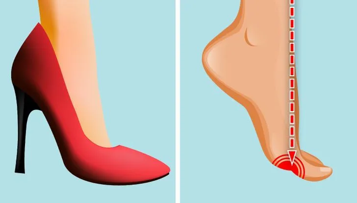 Tác hại khôn lường khi mang giày cao gót hàng ngày - Ảnh 3. Tác hại khôn lường khi mang giày cao gót hàng ngày - Ảnh 3.