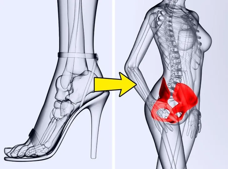Tác hại khôn lường khi mang giày cao gót hàng ngày - Ảnh 6. Tác hại khôn lường khi mang giày cao gót hàng ngày - Ảnh 6.