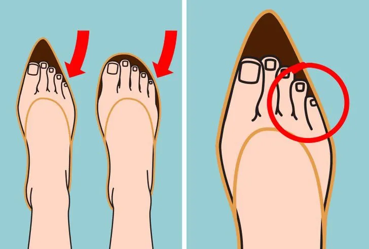 Tác hại khôn lường khi mang giày cao gót hàng ngày - Ảnh 7. Tác hại khôn lường khi mang giày cao gót hàng ngày - Ảnh 7.