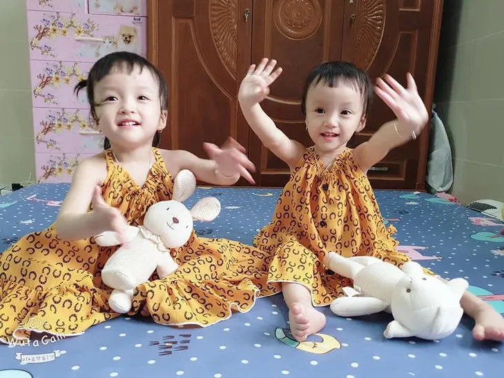 Tròn 1 năm ca mổ tách rời cặp song sinh Trúc Nhi - Diệu Nhi - Ảnh 3. Tròn 1 năm ca mổ tách rời cặp song sinh Trúc Nhi - Diệu Nhi - Ảnh 3.