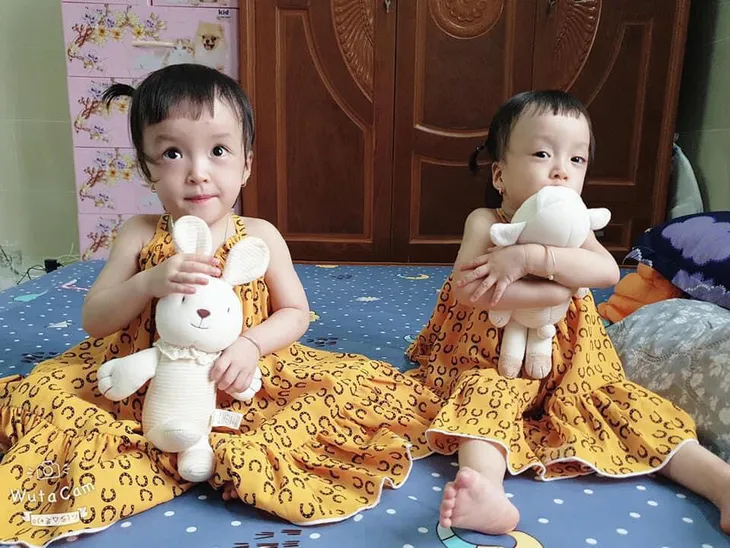 Tròn 1 năm ca mổ tách rời cặp song sinh Trúc Nhi - Diệu Nhi - Ảnh 2. Tròn 1 năm ca mổ tách rời cặp song sinh Trúc Nhi - Diệu Nhi - Ảnh 2.