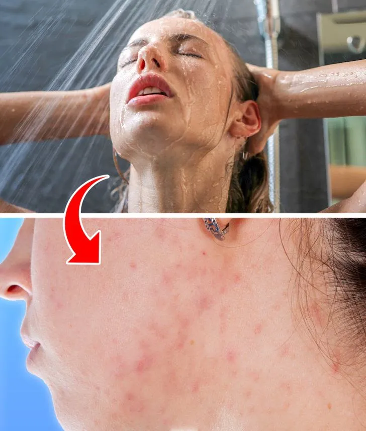 Tại sao không nên rửa mặt khi tắm vòi hoa sen? - Ảnh 1. Tại sao không nên rửa mặt khi tắm vòi hoa sen? - Ảnh 1.