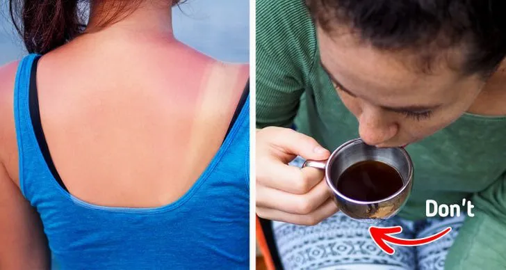 7 điều nguy hiểm cần tránh khi da của bạn bị cháy nắng - Ảnh 3. 7 điều nguy hiểm cần tránh khi da của bạn bị cháy nắng - Ảnh 3.