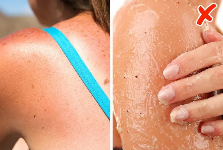 7 điều nguy hiểm cần tránh khi da của bạn bị cháy nắng - Ảnh 5. 7 điều nguy hiểm cần tránh khi da của bạn bị cháy nắng - Ảnh 5.
