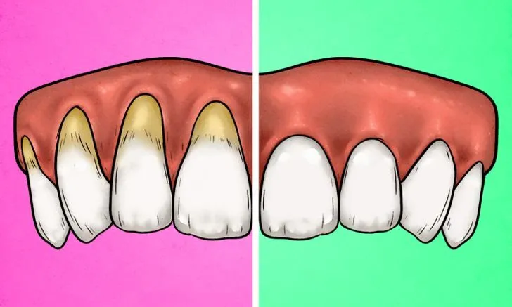 4 dấu hiệu cho thấy bạn đang đánh răng sai cách - Ảnh 1. 4 dấu hiệu cho thấy bạn đang đánh răng sai cách - Ảnh 1.