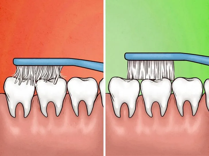 4 dấu hiệu cho thấy bạn đang đánh răng sai cách - Ảnh 5. 4 dấu hiệu cho thấy bạn đang đánh răng sai cách - Ảnh 5.