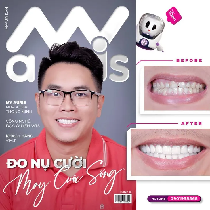 My Auris: Chăm sóc và làm đẹp răng bằng công nghệ hiện đại - Ảnh 4. My Auris: Chăm sóc và làm đẹp răng bằng công nghệ hiện đại - Ảnh 4.