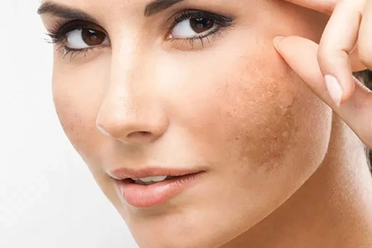 5 tác dụng chăm sóc da tuyệt vời của Vitamin C - Ảnh 2.
