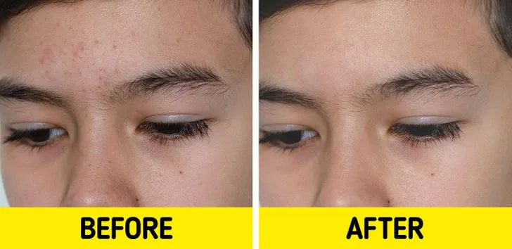 5 công dụng làm đẹp da bất ngờ của quả óc chó - Ảnh 3. 5 công dụng làm đẹp da bất ngờ của quả óc chó - Ảnh 3.