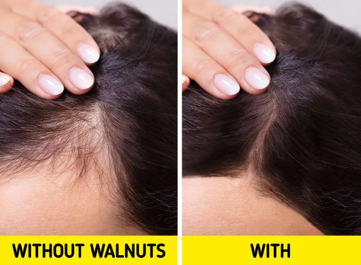 5 công dụng làm đẹp da bất ngờ của quả óc chó - Ảnh 6. 5 công dụng làm đẹp da bất ngờ của quả óc chó - Ảnh 6.