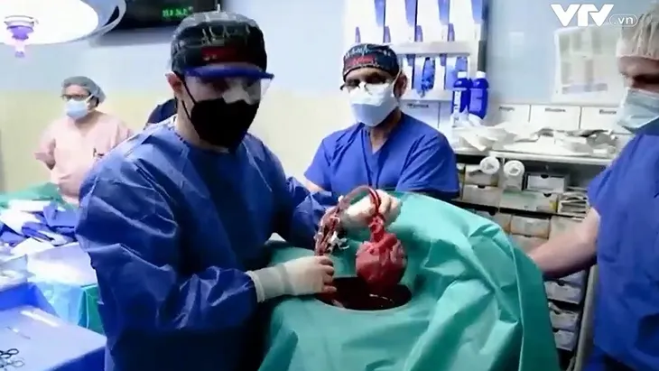 Thực hiện thành công ca cấy ghép tim lợn cho người - Ảnh 1. Thực hiện thành công ca cấy ghép tim lợn cho người - Ảnh 1.