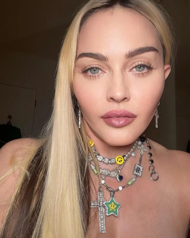 Các chuyên gia phẫu thuật thẩm mỹ nói về khuôn mặt mới của Madonna - Ảnh 2. Các chuyên gia phẫu thuật thẩm mỹ nói về khuôn mặt mới của Madonna - Ảnh 2.