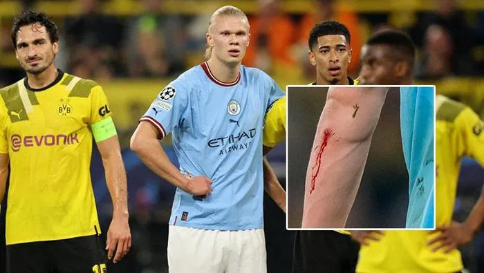 Vì sao Pep sớm rút Haaland ra khỏi sân trong trận gặp Dortmund? - Ảnh 1. Vì sao Pep sớm rút Haaland ra khỏi sân trong trận gặp Dortmund? - Ảnh 1.